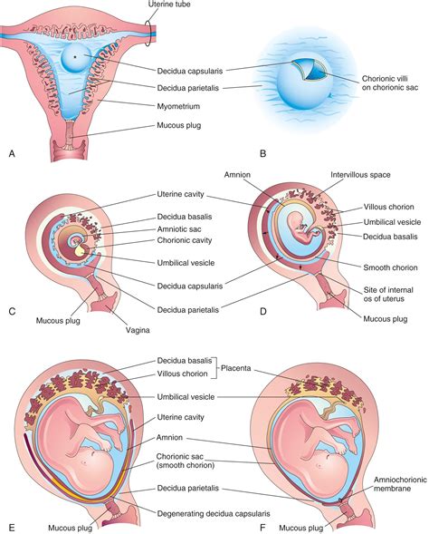 Placenta and Fetal Membranes - Clinical Tree