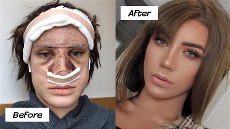 Plastic Surgery Disasters 的图像结果