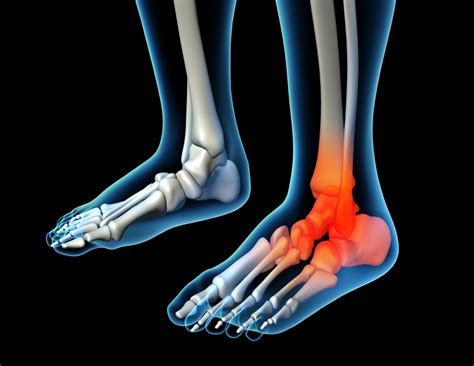 Ankle Pain | | Perfect Therapy