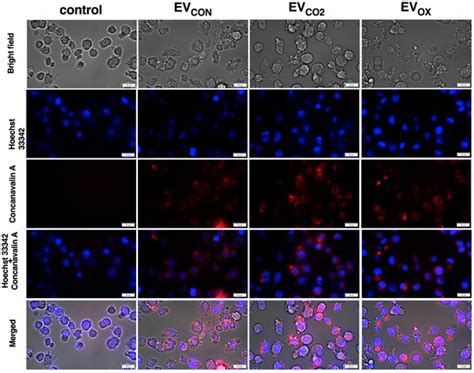 IJMS | Special Issue : The Role of Extracellular Vesicles in Cell ...