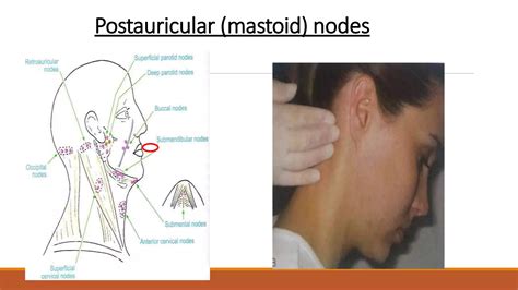 Lymphatic drainage of head and neck | PPTX