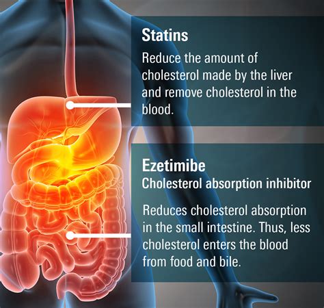 Side Effects Of Zetia Drug
