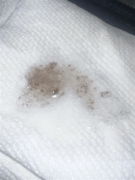 Coughing up mucus with brown specks : r/HealthQuestions