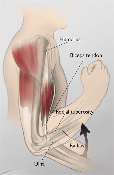 Upper Arm Muscles Pain