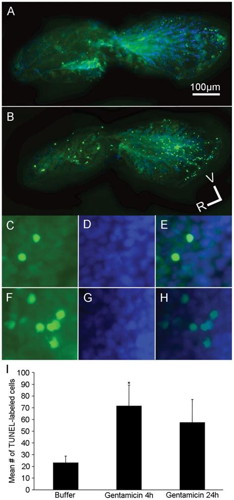 Image result for Intraperitoneal Injection in Fish