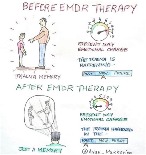 Image result for EMDR Tutorial