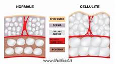cellulite e alimentazione cellulite come combatterla con l alimentazione is food cellulite e alimentazione cellulite come combatterla con l alimentazione is food