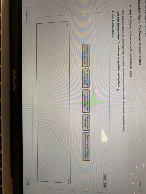 Image result for Crossed Extensor Reflex