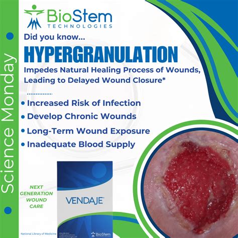 Granulation Tissue Wound Granulation Tissue Pathology Made Simple