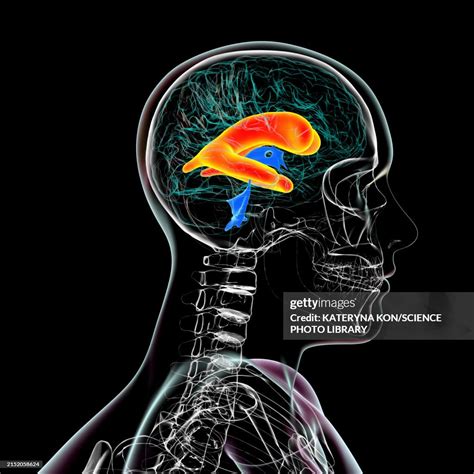 Enlarged Lateral Ventricles Of The Brain Illustration High-Res Vector Graphic - Getty Images
