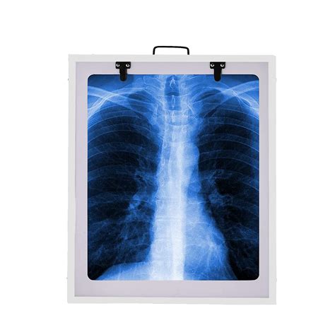 X-ray View Single (14X17 Inch) - White - Fidelis healthcare