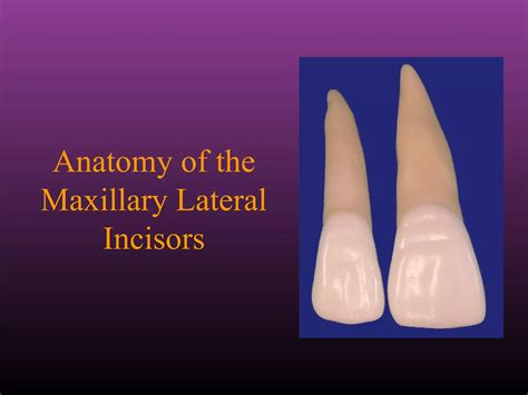 Maxillary Lateral and Mandibular Incisors | PPT