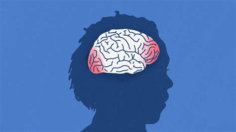 CTE Brain 的图像结果