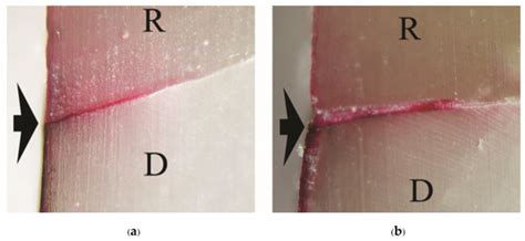 Marginal Micro-Seal and Tensile Bond Strength of a Biopolymer Hybrid ...