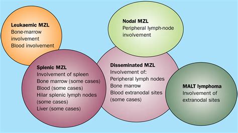 Splenic marginal-zone lymphoma: a distinct clinical and pathological entity - The Lancet Oncology