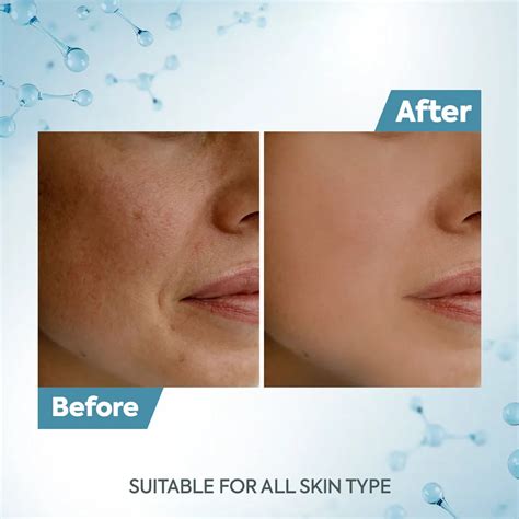 Raaga Professional De Tan Removal Creme With Kojic & Milk