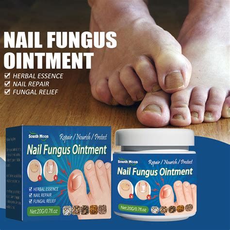 20g Nail Fungus Cream Toenail Fungus Remover Treatment Care Infection ...