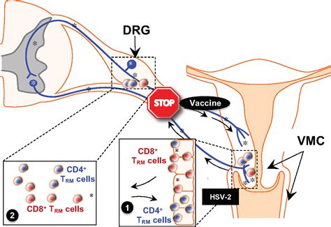 Herpes simplex virus 1 2 igg