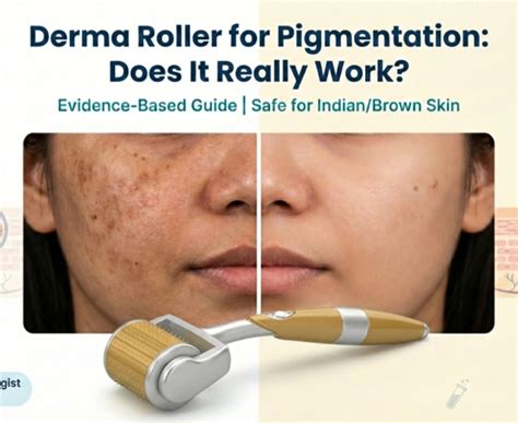 Derma Roller for Pigmentation: Does It Fade Dark Spots?