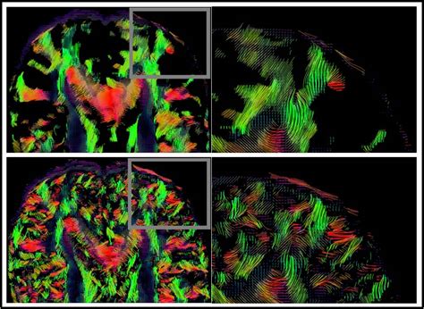Medical Image Computing and Signal Processing Lab | Gallery