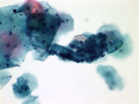 Pathology Outlines - Normal and nonneoplastic findings