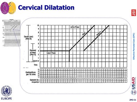 Image result for Partogram Examples
