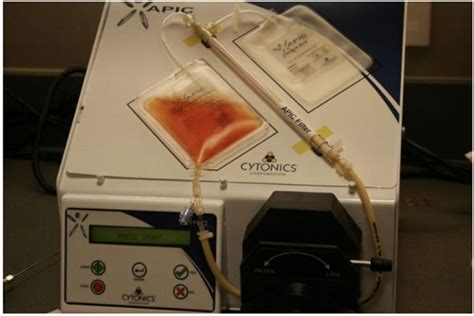 Image result for Disc Infusion