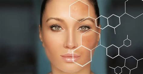 Banish Dark Spots for Good: A Dermatologist's Guide – Classic Derma