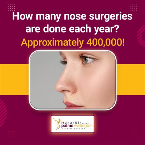 Dr. Itzhak Nir,MD,F.A.C.S. (@doctor_nir) • Instagram photos and videos