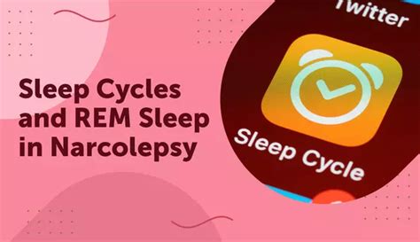 Narcolepsy Sleep Cycle Graph 的图像结果