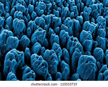 Electron Microscope 的图像结果