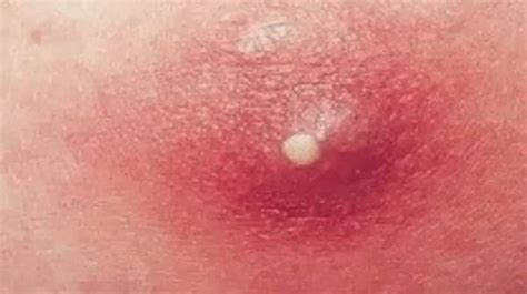 Carbuncle Core 的图像结果