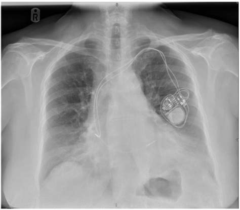 Hearts | An Open Access Journal from MDPI