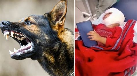 Brutal! Rabid Dog Attacks 3-Year-Old In MP’s Gwalior; Rips Her Lips Apart