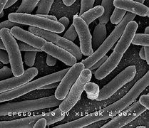 Image result for baCterial