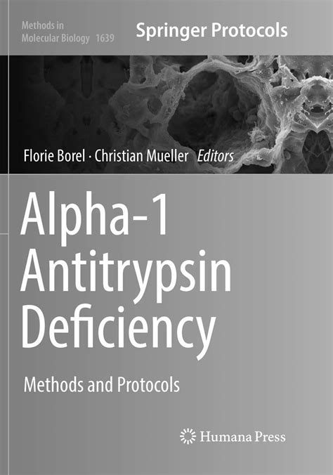 Buy Alpha-1 Antitrypsin Deficiency: Methods and Protocols: 1639 ...