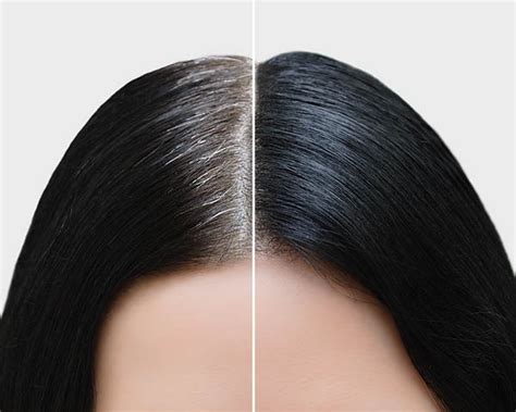 2 Instant & Effective Beauty Hacks To Cover Greys | Femina.in