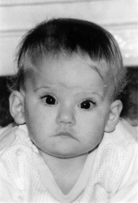 The face of Smith-Magenis syndrome: a subjective and objective study ...