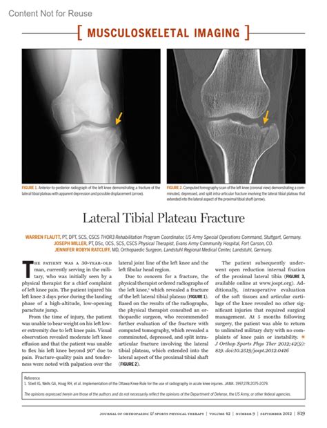 Lateral Tibial Plateau Fracture : Journal of Orthopaedic & Sports Physical Therapy