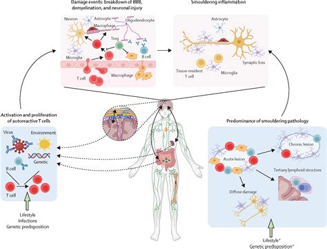 Multiple sclerosis - The Lancet