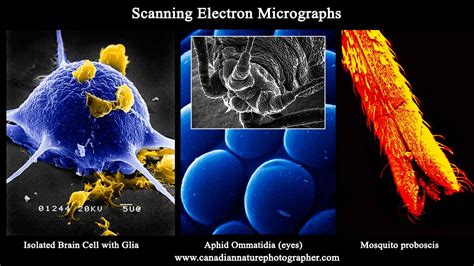 Scanning Electron Microscope Cell 的图像结果