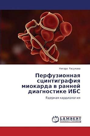 Buy Perfuzionnaya Stsintigrafiya Miokarda V Ranney Diagnostike Ibs Book ...