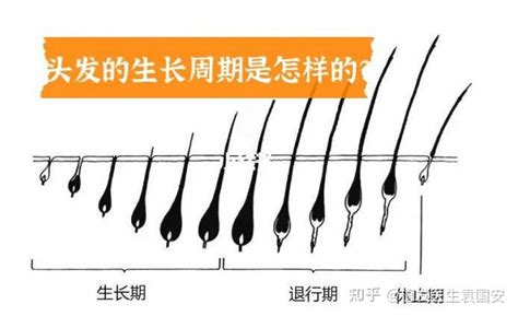 分享杭州大麦微针植发2700单位案例，希望能帮到你-发友网