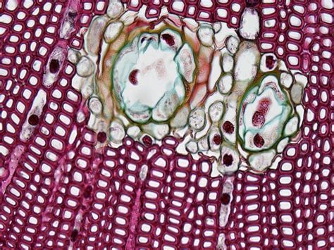 Common fatty acid contributes to temperature, pain sensitivity in ...