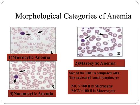 Microcytic hypochromic anemia | PPTX