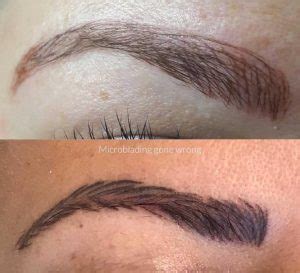 How to Fix Bad Microblading Eyebrows for Better Results