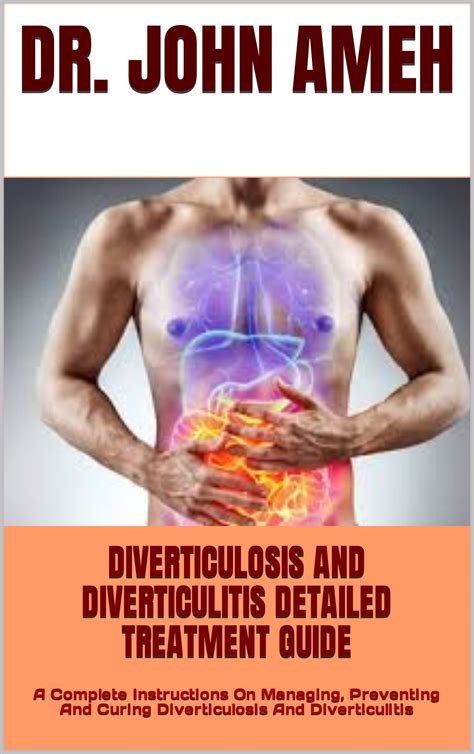 Buy DIVERTICULOSIS AND DIVERTICULITIS DETAILED GUIDE : A Complete ...