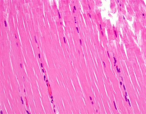 Skeletal Muscle Histology STRIATED, SKELETAL MUSCLE | Microanatomy Web