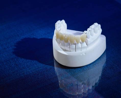 Smile Stones Dental Pvt Ltd