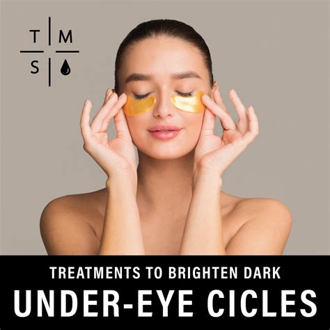 5 Treatments to Get Rid of Dark Under-Eye Circles — The Med Spa